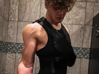 Teen Bodybuilder’s Arm Stays Skinny Despite Exercise, Then The Truth Comes Out