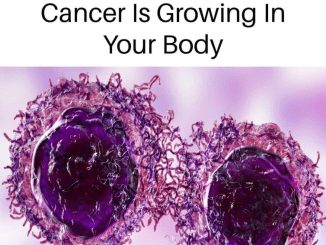 20 Cancer Signs People Ignore Until It’s Too Late