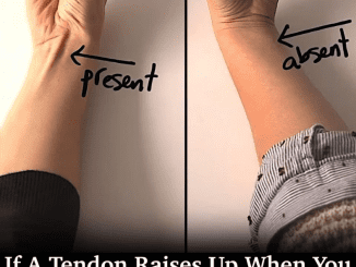 If a Tendon Raises Up When You Touch Your Pinky to Your Thumb, Here’s What It Could Mean