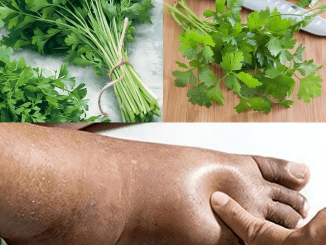 Optimize Fluid Balance Naturally with Parsley