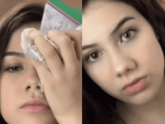 Teens Are Holding Bags Of Bleach On Face To Change Eye Color