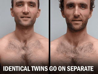 Identical Twins Trailed a Vegan Diet Vs. Omnivorous Diet