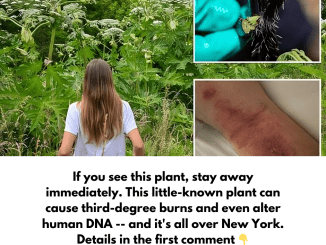 This little-known plant can cause third-degree burns and even alter human DNA — and it’s all over New York