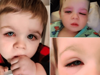 Mom issues warning after toddler nearly lost eyesight from bath toy