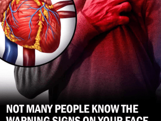 Signs On Your Face and Head That Could Indicate Heart Trouble