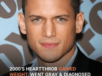 2000’s Heartthrob Gained Weight, Went Gray & Was Diagnosed with Serious Condition after ‘Prison Break’ – Before & after Pics