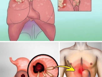 8 Surprising Signs Of Lung Cancer Even If You Aren’t A Smoker