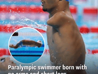 Paralympic swimmer born with short legs and no arms obliterates the competition leaving people stunned