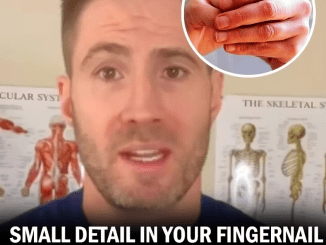 There’s a Subtle Detail in Your Fingernail That Could Indicate Risk of Sudden Death