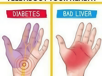 Hands Reflect our Health – Here’s What Your Hands Can Reveal About Your Health