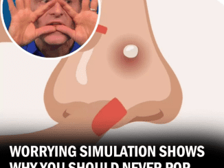  Scary Demonstration Shows Why You Should Never Pop Pimples In The ‘Triangle of Death’ On Your Face