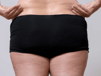 9 conditions that could actually explain unexpected weight gain