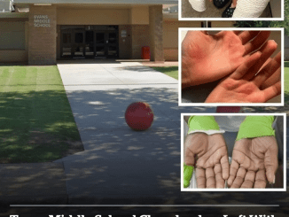 Texas middle school cheerleaders left with first and second-degree burns after alleged ‘malicious punishment’ from coach