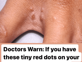 If You Have These Tiny Red Dots On Your Arm, Do Not Ignore The Warning Signs