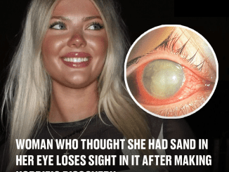 Woman who thought she had sand in her eye loses sight in it after making horrific discovery