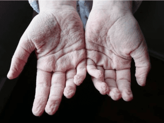 Our Hands Wrinkle When Soaked in Water – Do You Know the Truth Behind It?