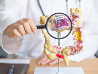 I’m a doctor — these 5 concerning symptoms may indicate colon cancer