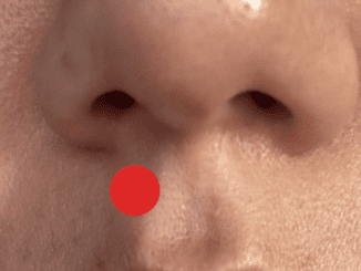 If you press this point under your nose, this is what it does to your body