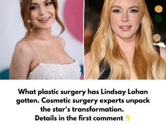 What plastic surgery has Lindsay Lohan gotten. Cosmetic surgery experts unpack the star’s transformation