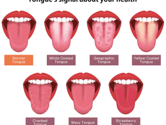 Your Tongue Health And Deciphering Its Health Clues