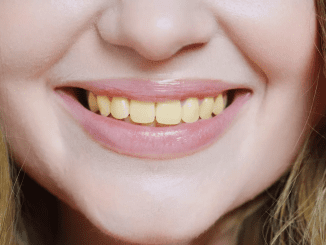 Dentist warns people about the one main mistake they are making that makes their teeth go yellow