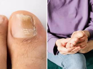 Official NHS advice as pharmacist reveals two warning signs of silent killer that you might see on your feet